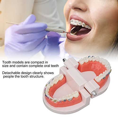 Modelo de dentes, modelos de dentes dentários Crianças estudos de ensino odontológico suprimentos com suporte ortodôntico