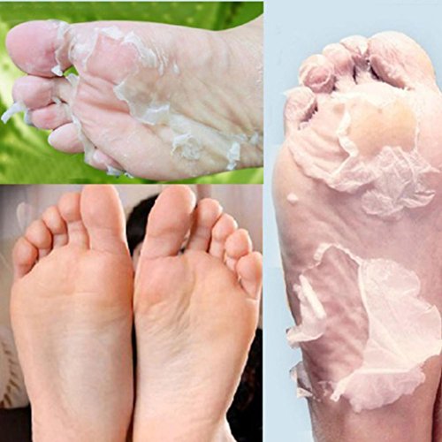 Cutículas de salto de envelhecimento do pé de esfoliação descascando os pés mortos Cuidados com a pele de 5 ml Removentes