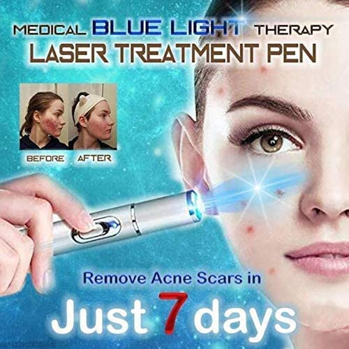 Definir Treatamento Home Blue Light Terapia varizes Pen para as veias da aranha - prata 1 contagem