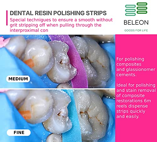 Tiras de polimento dentário - Arquivo dental para polidores de dente para dentes lixando moagem de dentes profundos ferramenta de limpeza de dente