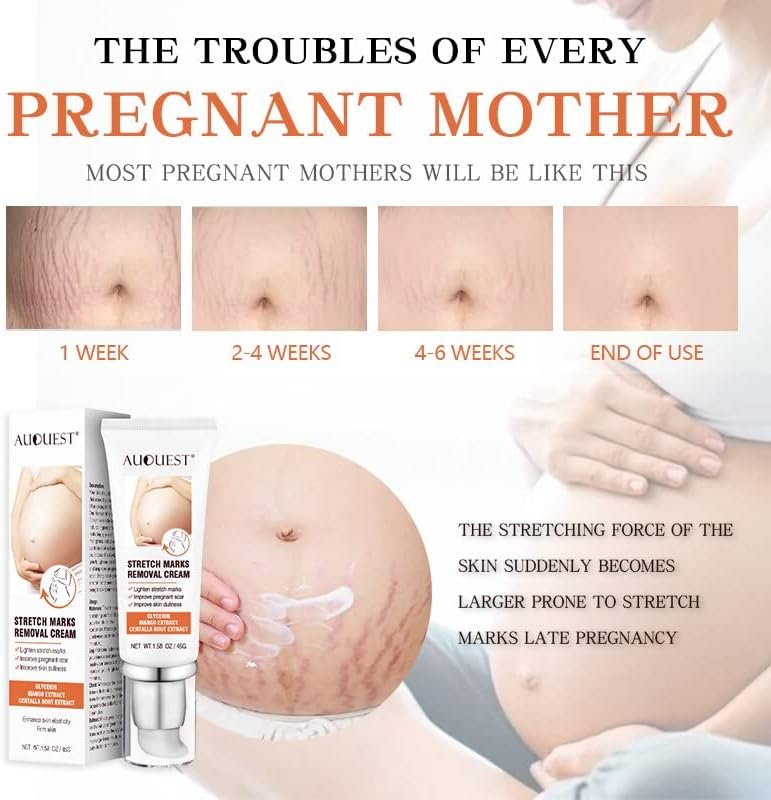 Remoção de estrias Creme de maternidade Removedor de acne de cicatriz para mulheres grávidas Antienvelance Skin Firming