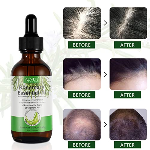 Óleo essencial de alecrim, óleo de alecrim tópico para crescimento de cabelo, natural orgânico natural, redução de perda de