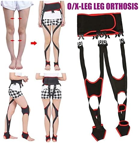 Cinturão de correção da perna mjad banda de alisamento de cinta x-perna para mulheres e homens, joelhos respiráveis ​​de deformidade