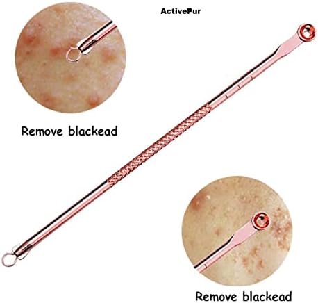 Ferramenta de extrator de pimple -pimple de removedor de cravo, kit de remoção de acne eficaz, tratamento para manchas de manchas,