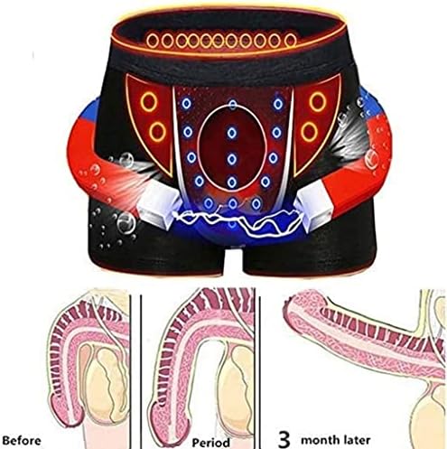 MENINOS RECIMENTOS TEAPIA MAGNÉTICA CARELENTE MODALMENTE O MOMELÓGIO DO BRIAGEM BORREGES DE BOIXADOR DE