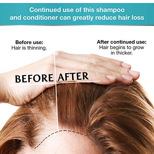 Shampoo de biotina e conjunto de condicionadores e shampoo para volume - Tratamento e condicionador de xampu de cabelo espessante para cabelos secos, normais, oleosos e tratados com cores