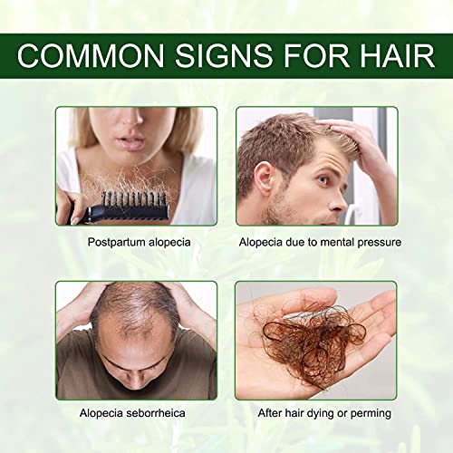 Óleo de alecrim para crescimento de cabelo, óleo essencial de alecrim, natural para cuidados com a pele e cabelos, óleo de fortalecimento