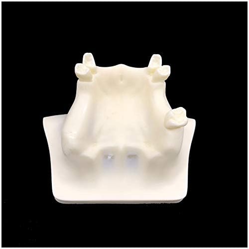 KH66ZKY Modelo de Treinamento de Levantamento de Levantamento Sinusal Maxilar - Modelo de dentes dentários - Modelo de